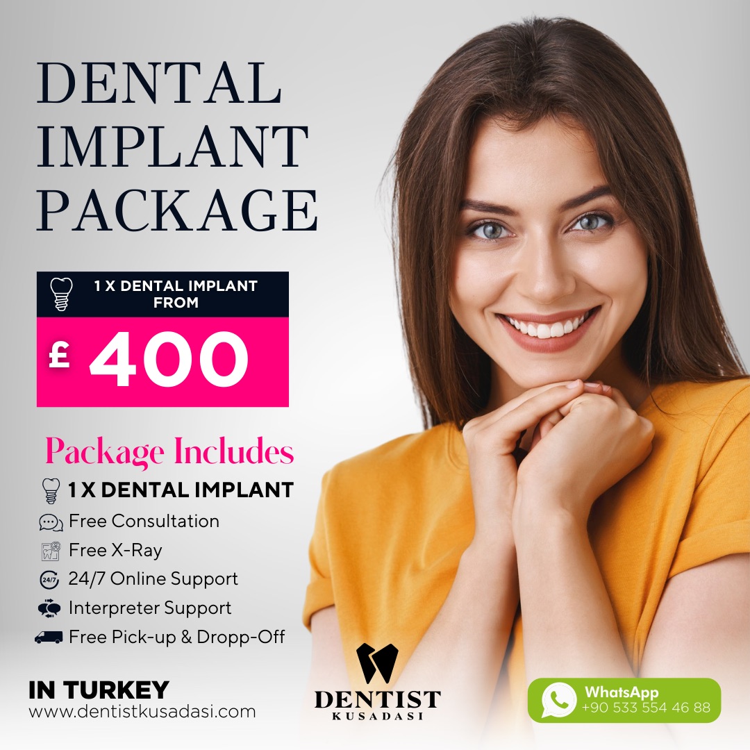 Dental Implant Package Offer