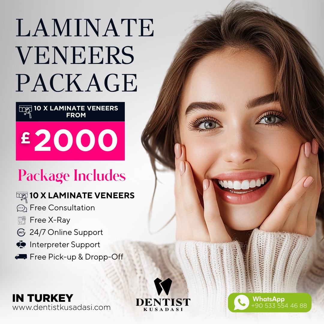 Laminate Veneers Package Offer