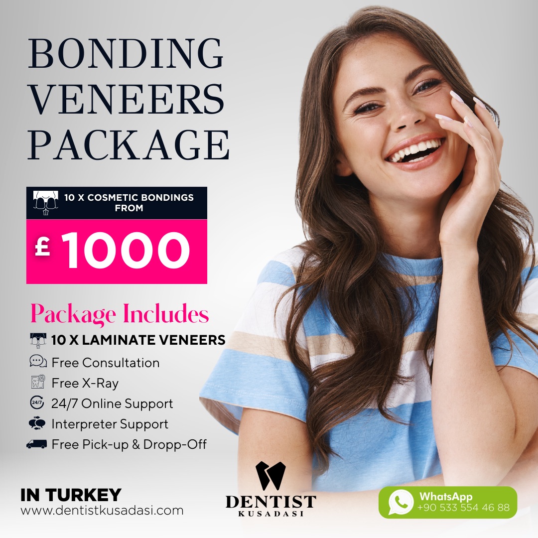 Bonding Veneers Package Offer img