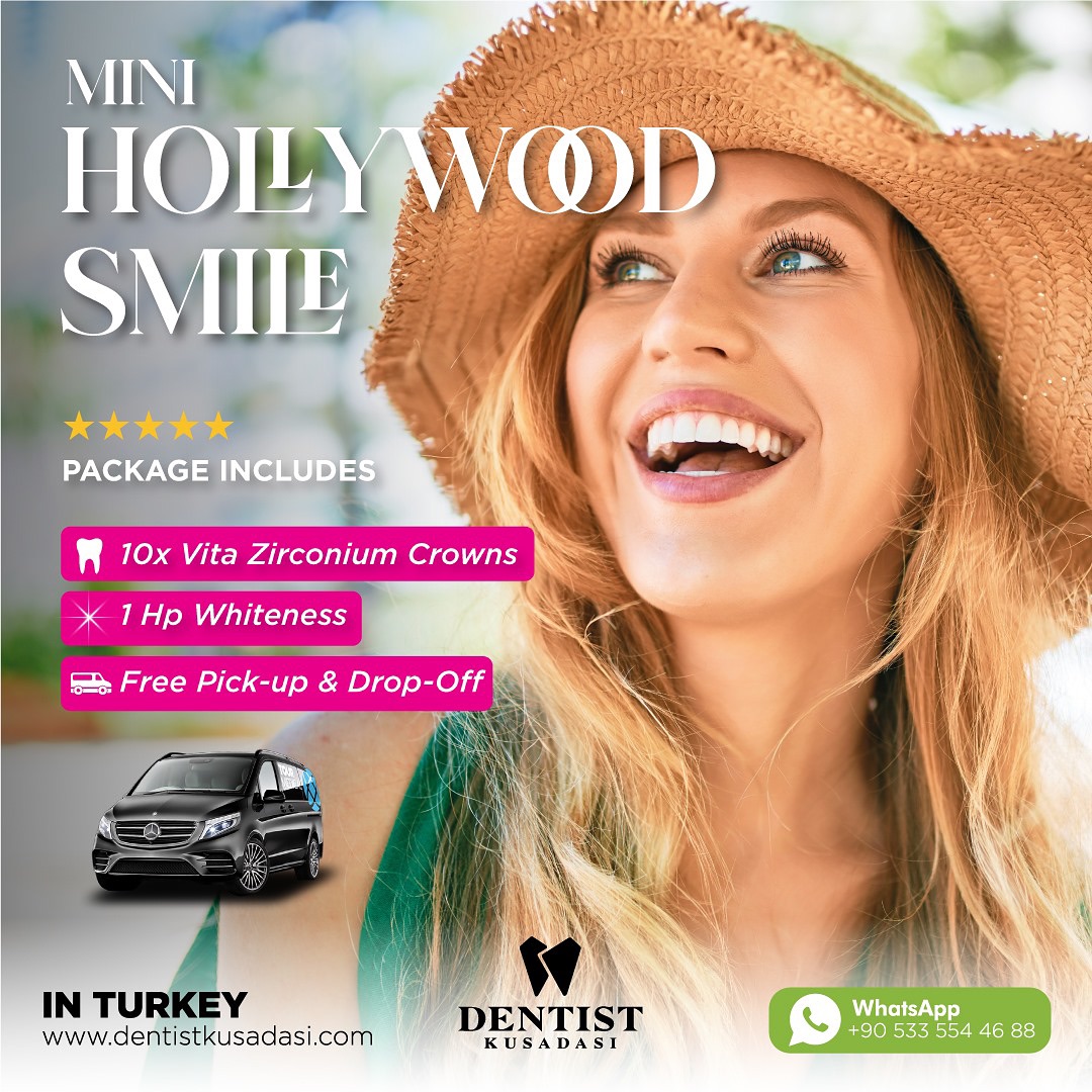 It’s the perfect time for a Mini Hollywood Smile package, just like the smiles of Hollywood stars!?